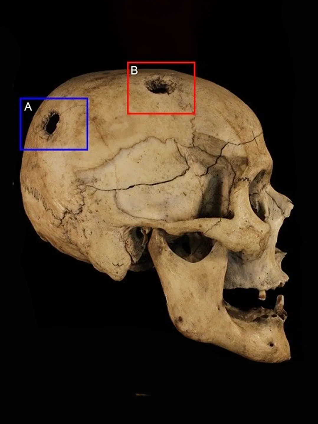 Un antropologo forense scansiona in 3D ossa e resti scheletrici sul luogo di un decesso